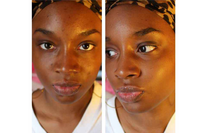 How to get rid of black spots on your face in just 15 minutes theinfong.com 700x460