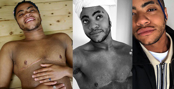 Sade Adu S Transgender Son Shows Off His Chest After Removing ‘her Boobs Theinfong