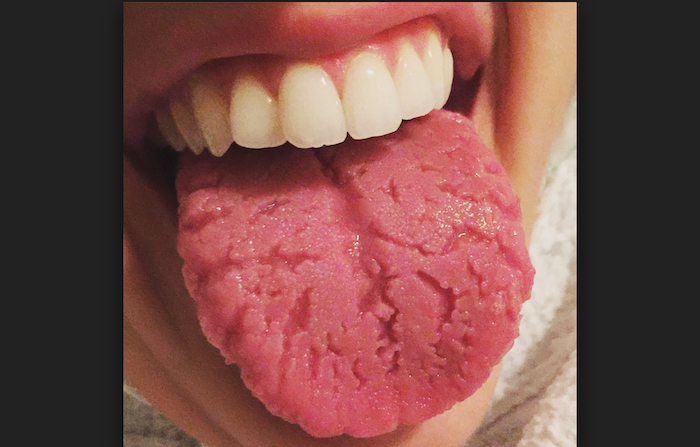6 Things Your Tongue Reveals About Your Health Everyone Needs To See