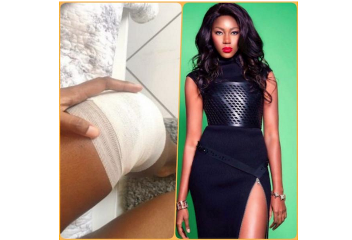 yvonne-nelson-injure-her-knee-dancing-during-31st-birthday-celebration-theinfong-com-700x478