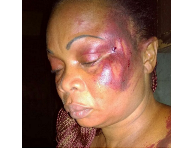 How a woman was beaten mercilessly by her jealous husband