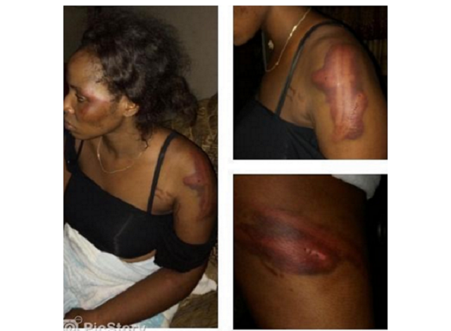 How female student of Abraham Adesanya poly was beaten