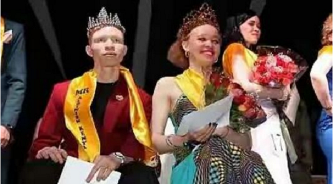 kenya-hold-first-mr-miss-albinism-pageant