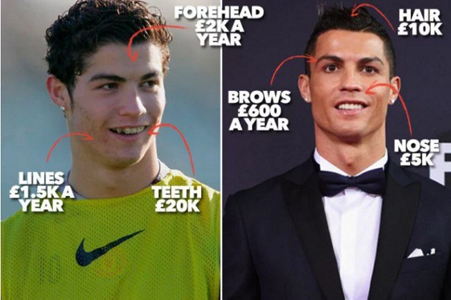 footballers-that-have-done-plastic-surgery