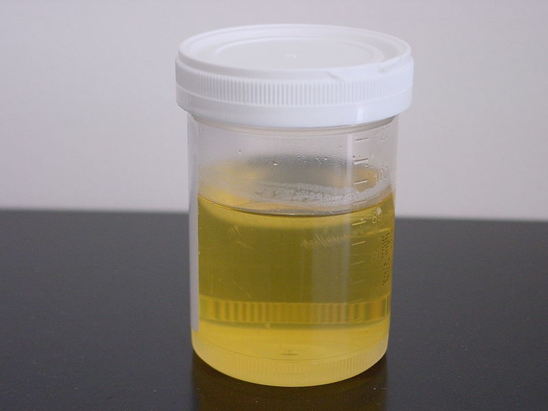 What the colour of your urine tells you about your health theinfong.com