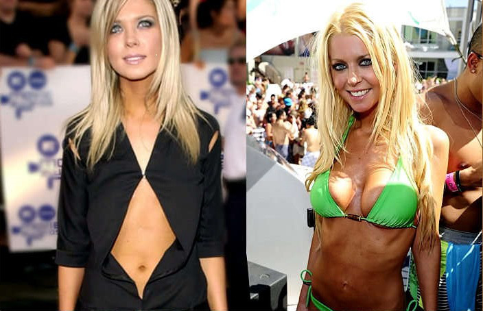 Top 12 Celebrity Plastic Surgery Operations Gone Horribly Wrong