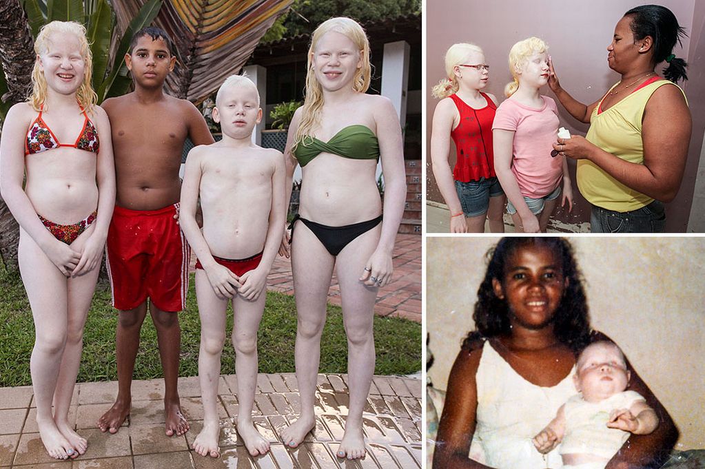 Meet Black Woman Who Gave Birth To 3 Albino's Under A Rare Conditi...