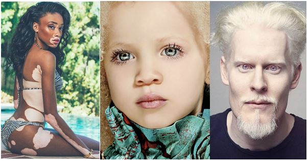 Idol konvergens Støvet 8 gorgeous celebrities with unique skin colours | Theinfong