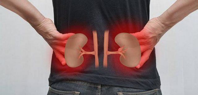 Kidney problem