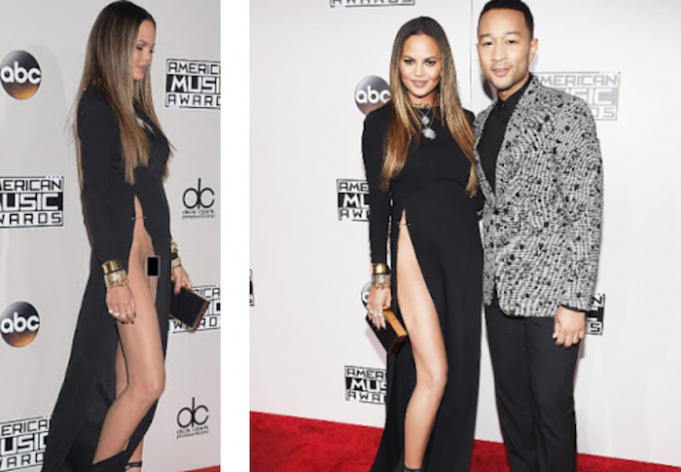 Chrissy Teigen Apologizes For Exposing Her Privates When She Suffered