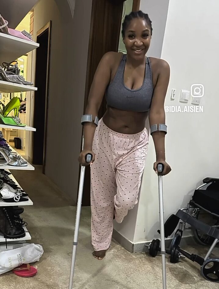 Actress Idia Aisien survives serious accident, sustains multiple injuries on her leg