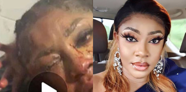 Angela Okorie Porn - Photos of actress Angela Okorie covered in blood after gunmen riddled her  car with bullets | Theinfong