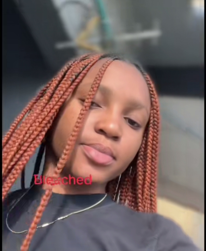 Lady shares her bleaching journey and how she made the tough decision to stop