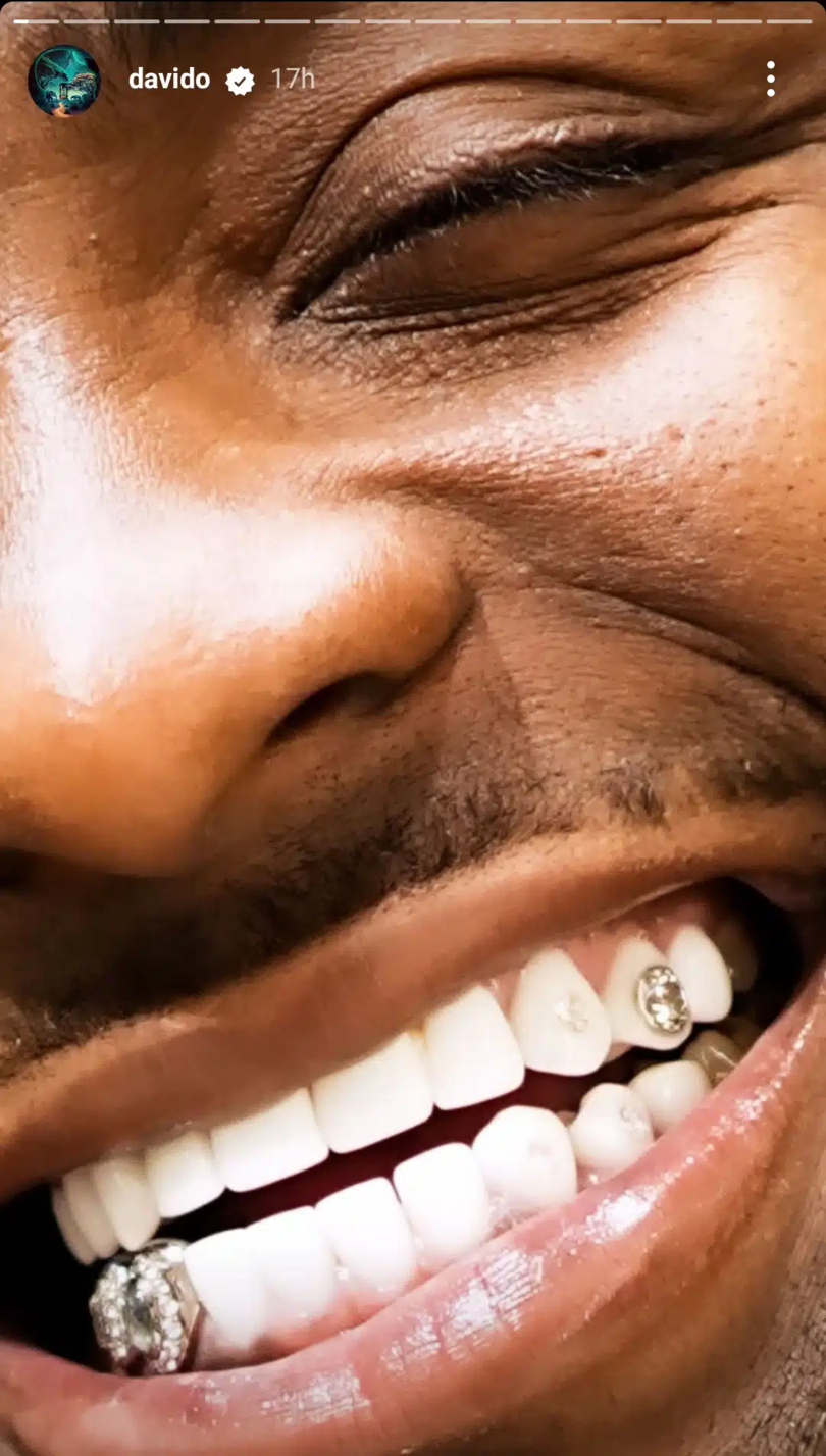 Davido diamond teeth