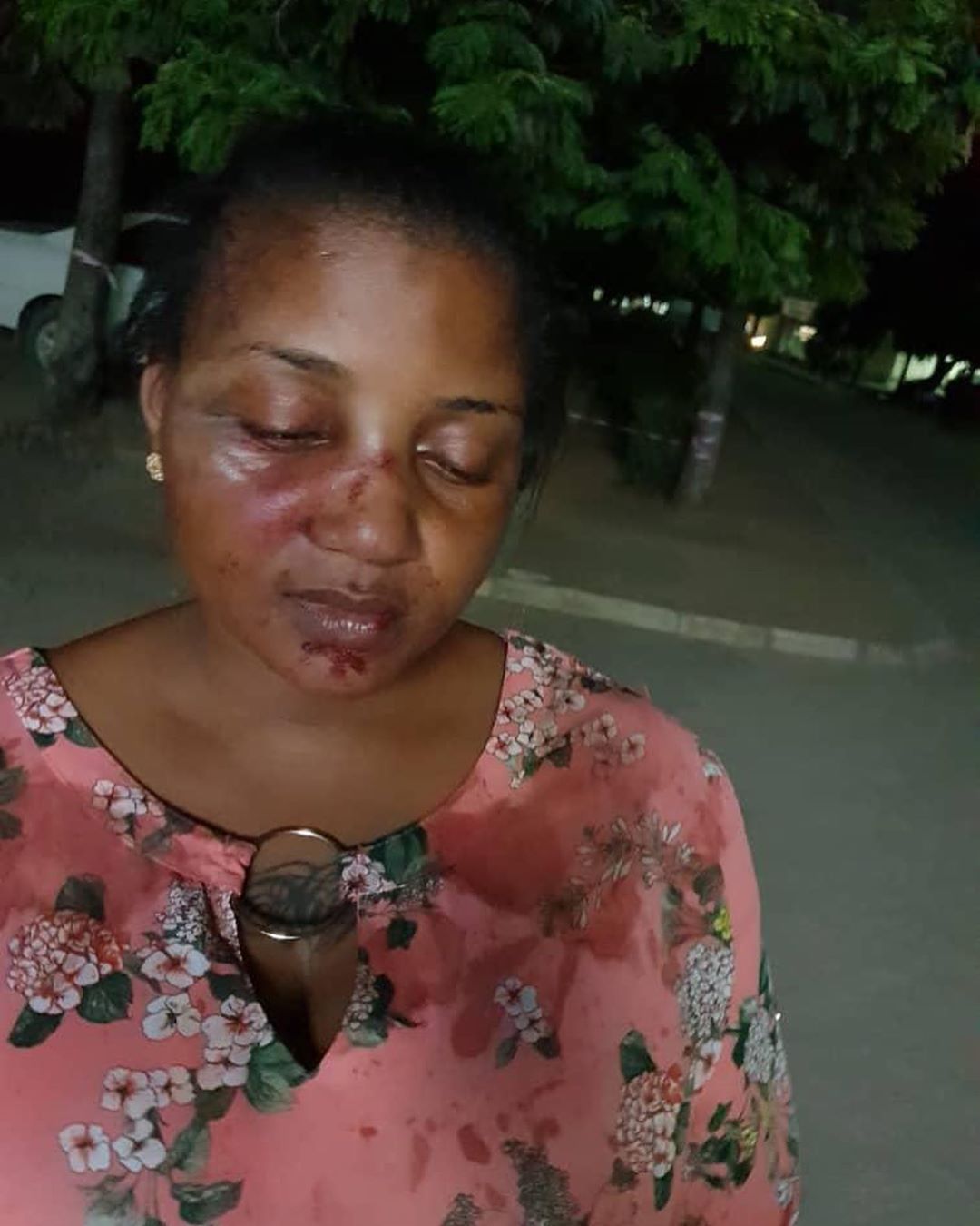 actress-zena-yusuf-with-battered-face