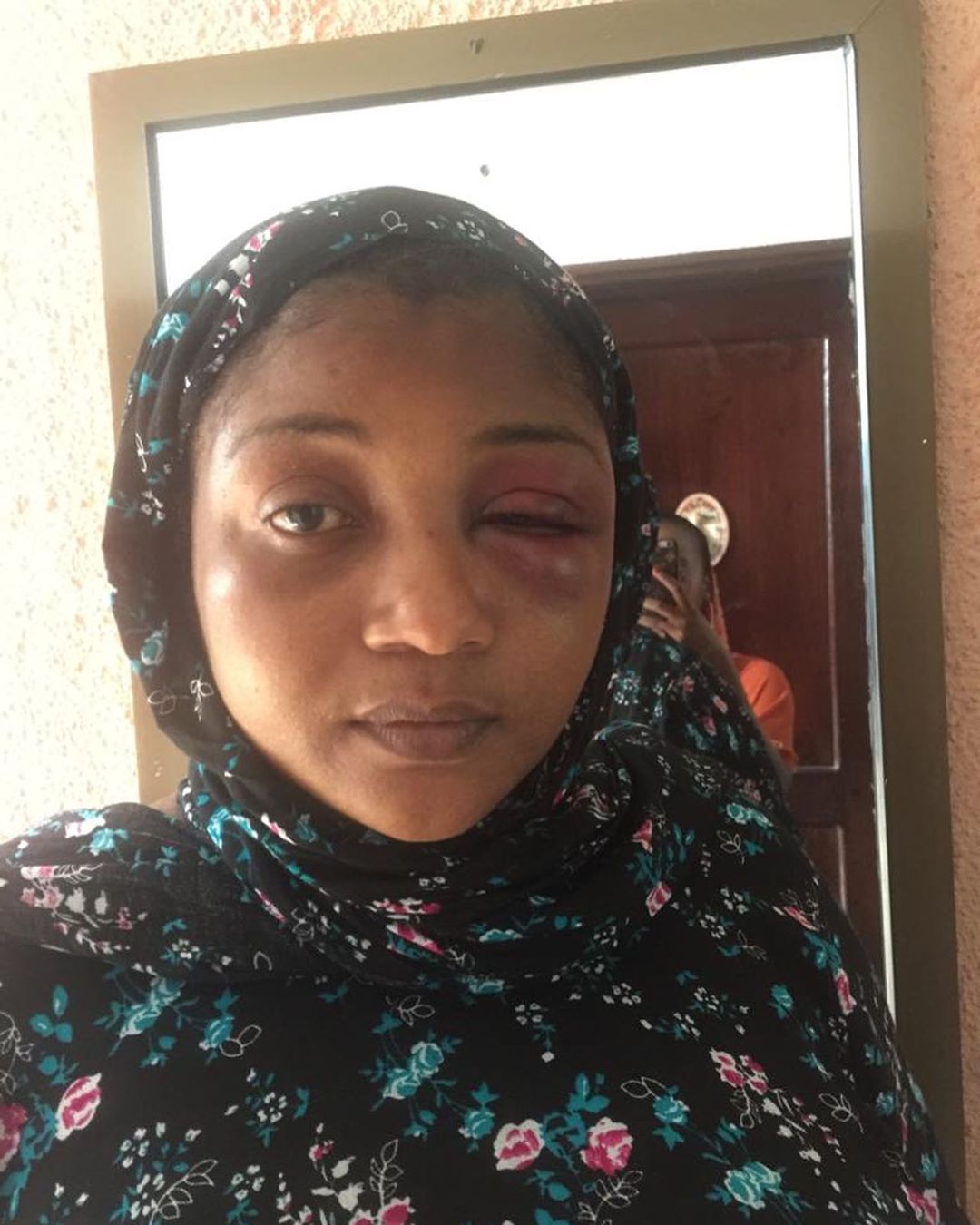 actress-zena-yusuf-with-battered-face