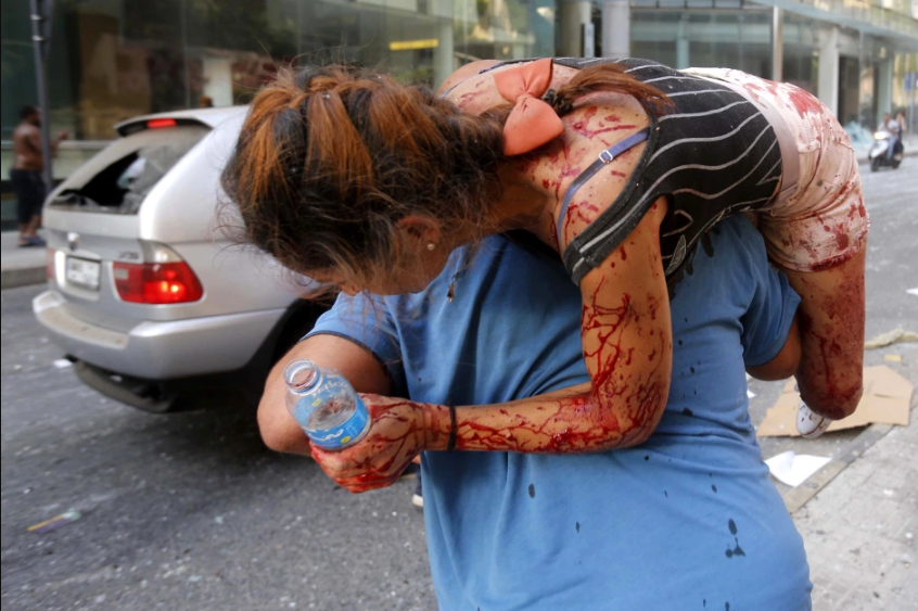 beirut-explosion-injured-victims