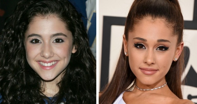 Busted: 13 celebs hiding their plastic surgery from the public (Before ...