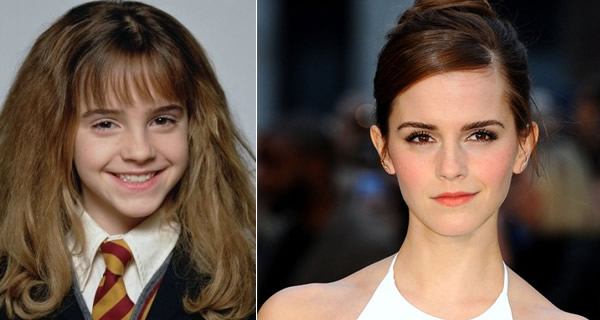 10 awkward celebrity kids who grew up to be very hot - I bet you can't ...