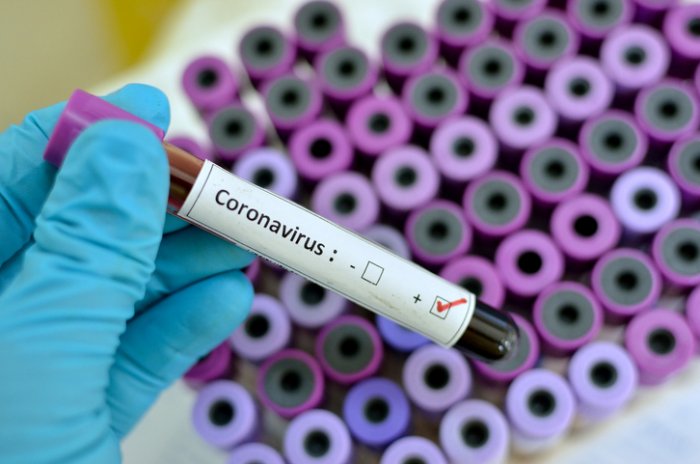 8 new cases of coronavirus confirmed in Nigeria, total now 232