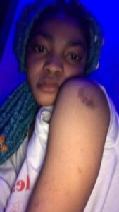 Davido’s artiste, Lil Frosh accused of regularly beating up his video vixen girlfriend (Photos)