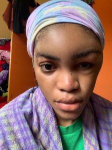 Davido’s artiste, Lil Frosh accused of regularly beating up his video vixen girlfriend (Photos)