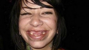 Disgusting People Who Need To See A Dentist Immediately Their Teeth Will Make You Cringe