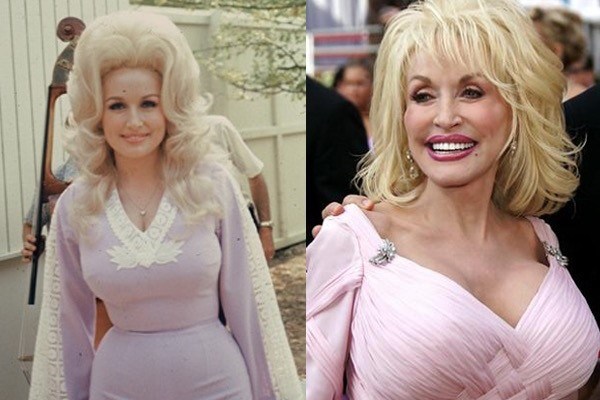 Top 12 celebrity plastic surgery operations gone horribly ...