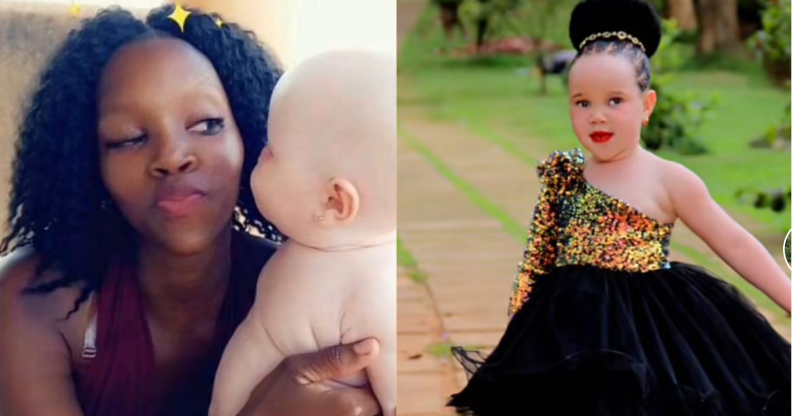 Lady shares beautiful transformation of her albino daughter